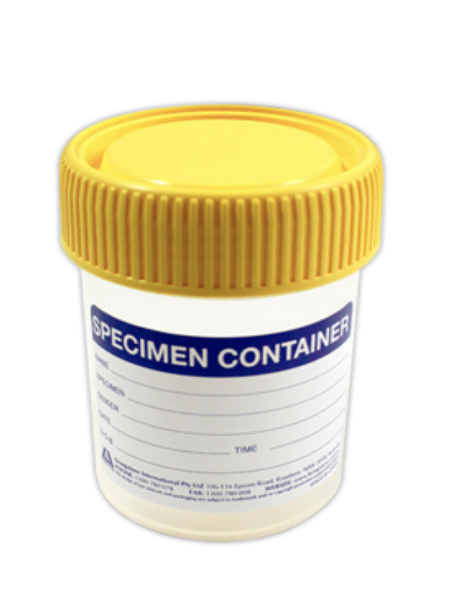 Speciman Containers Specimen Container 70ml - Novaura Medical & Hygiene Supplies